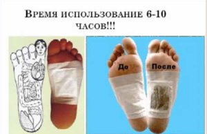 Использование пластыря для стоп Киноки от токсинов