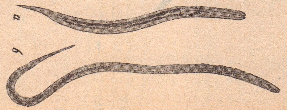 диагностика стронгилоидоза