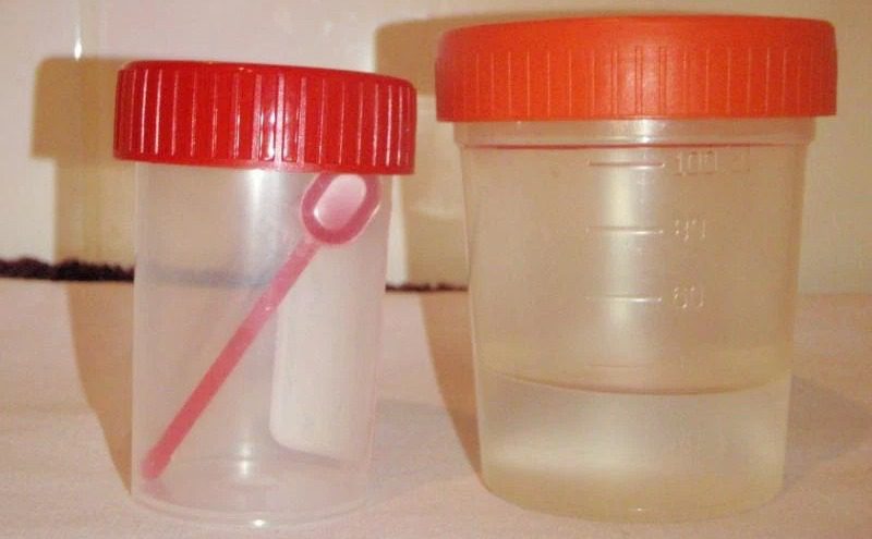 контейнер для анализов