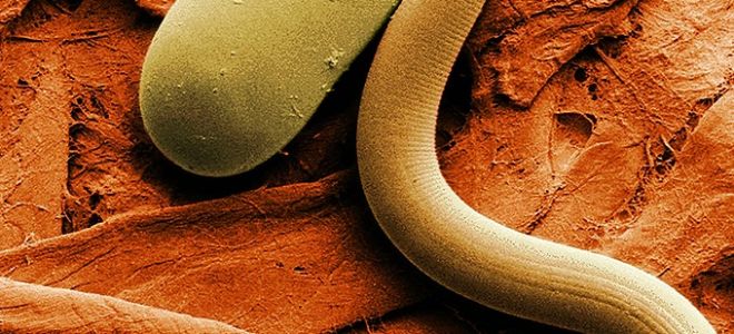 Чем лечить острицы у детей