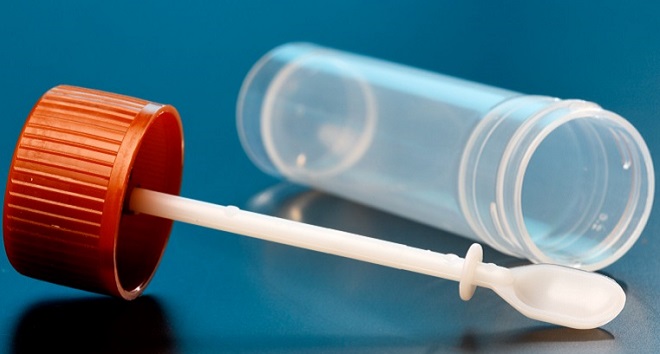 Анализ кала на яйцеглист - метод диагностики описторхоза