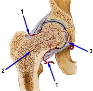 Сосуды шейки бедра Перелом может нарушить кровоснабжение шейки бедра