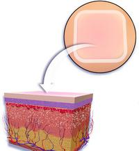 Недостатки гормонального пластыря Евра