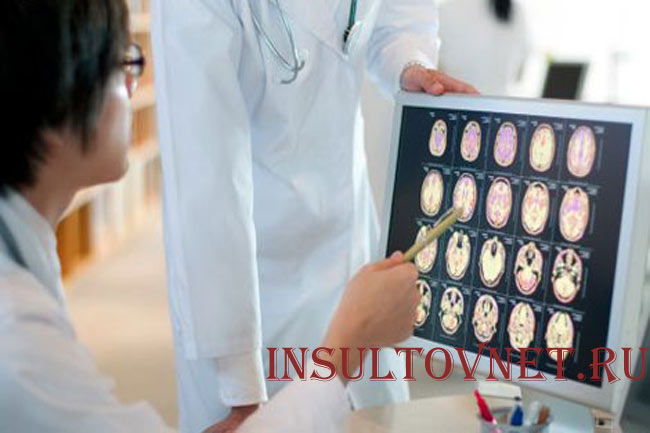 Диагностика при инсульте