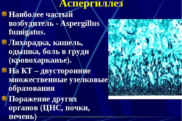 Аспергиллез