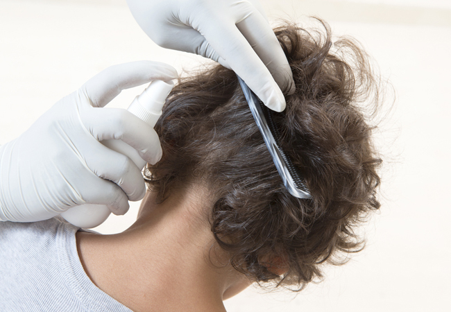 чем лечить педикулез