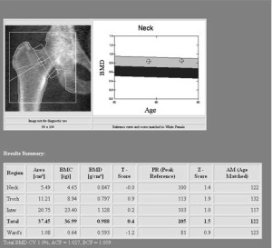 Денситометры различают: по принципу измерений
