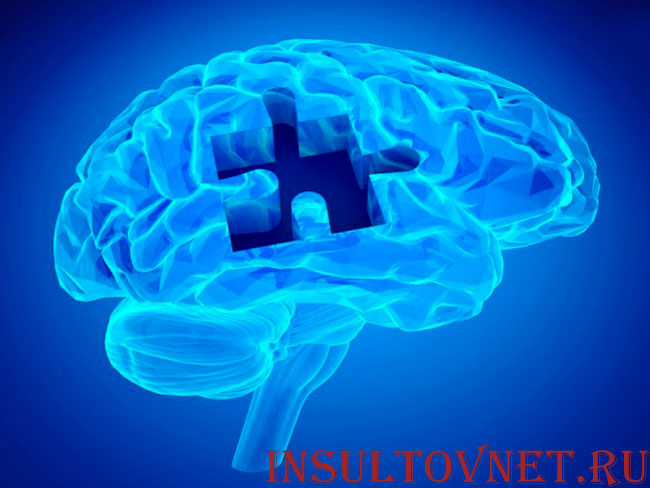 разрушение мозга