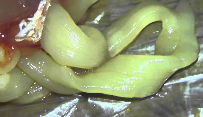 опасность глистов