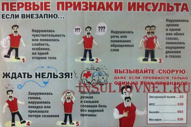 Признаки инсульта