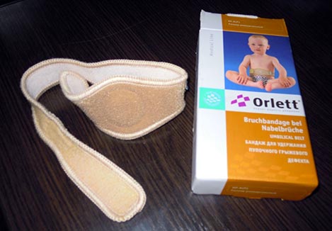 Лечение пупочной грыжи у детей без вмешательства хирурга