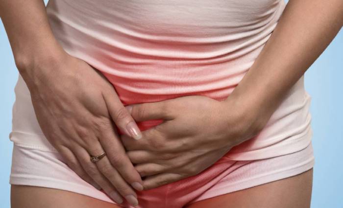 хламидиоз у женщин