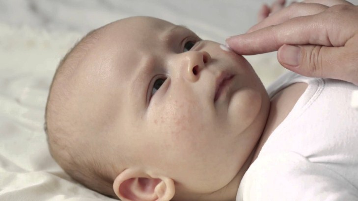 дерматит у ребенка