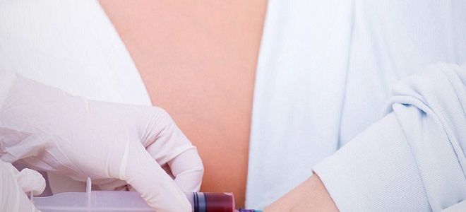 Анализ крови на токсоплазмоз при беременности