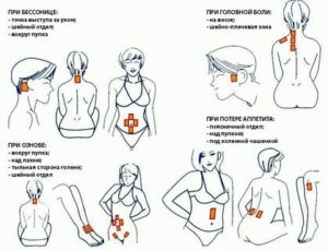 При каких симптомах эффективен пластырь Салонпас