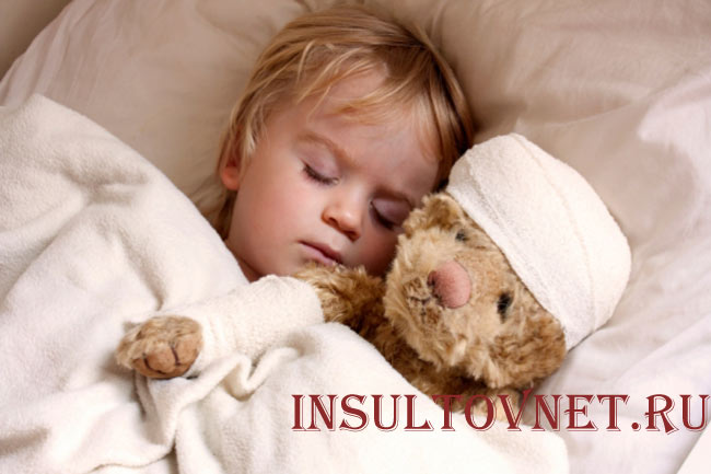 Эпилепсия при сотрясении