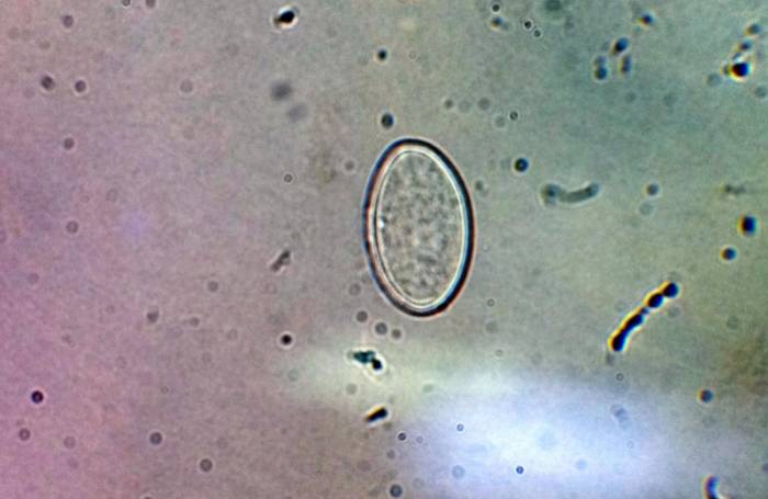 Энтеробиоз