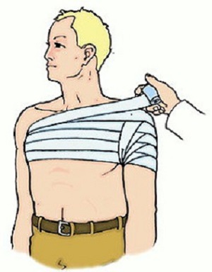 Повязка при вывихе Тугая повязка — первая доврачебная помощь при вывихе плечевого сустава