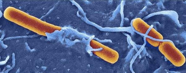 шигелла Бойда