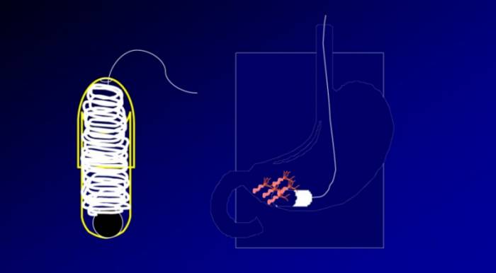 интеротест