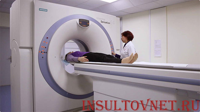 компьютерная томография