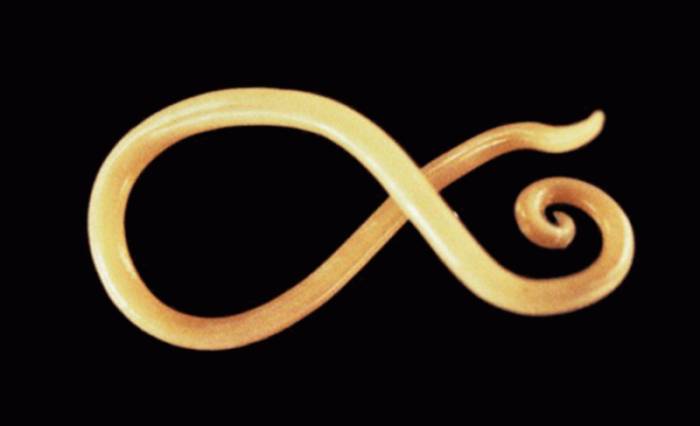 Человеческая аскарида