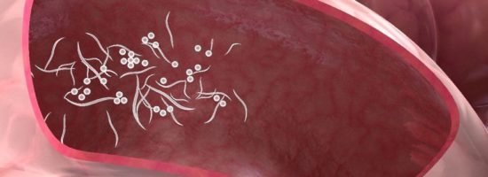 острицы в кишечнике