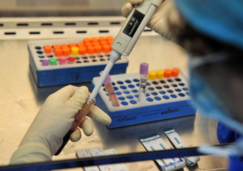 анализ на описторхоз