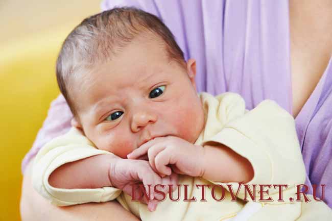 Косоглазие у детей