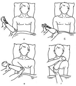 Схема вправления вывиха плеча по методу Кохера Схема метода Кохера