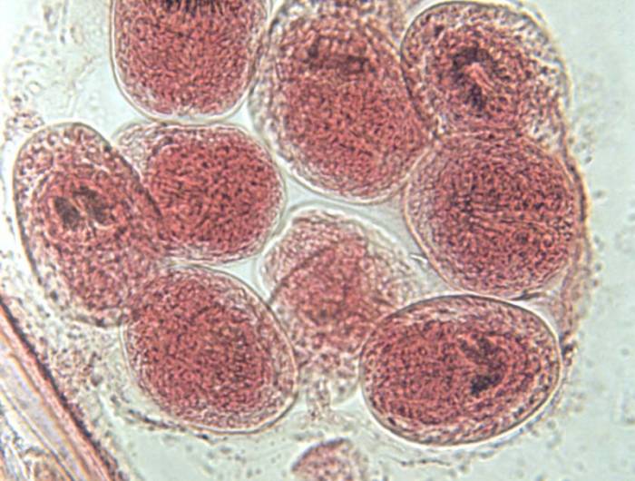 размножение эхинококка