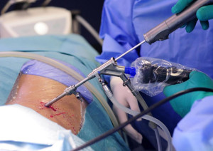 Операция Дискэктомия