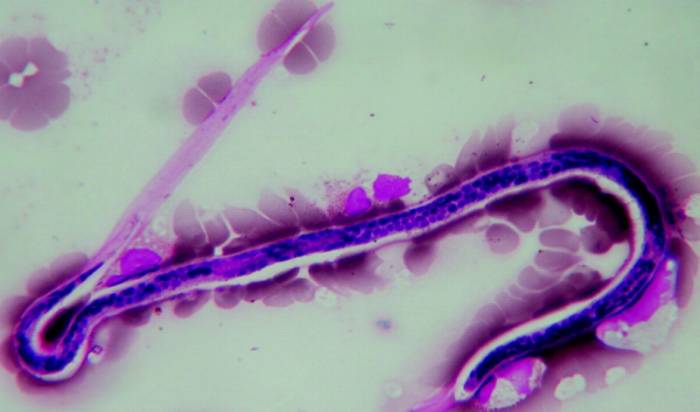 нитчатки паразиты