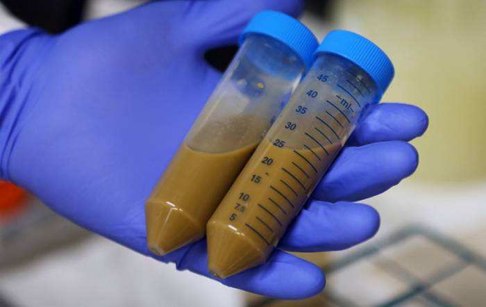 анализ на кал