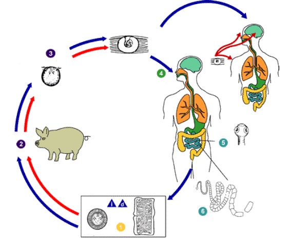 как заразиться Тениозом