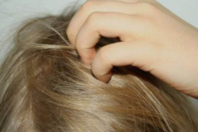 чешется голова