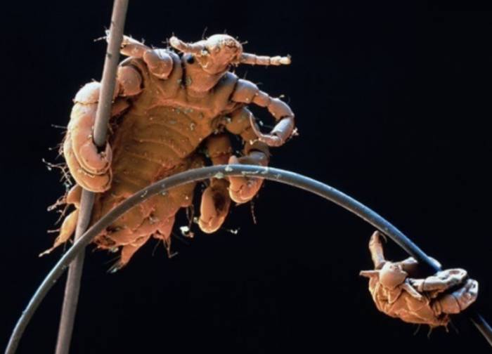 Лобковые вши