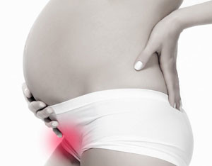 Беременная женщина Симфизит при беременности