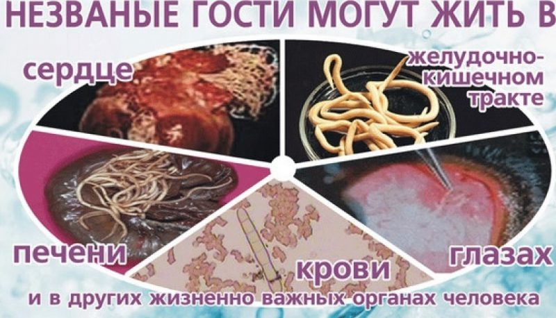 Особенности гельминтозов