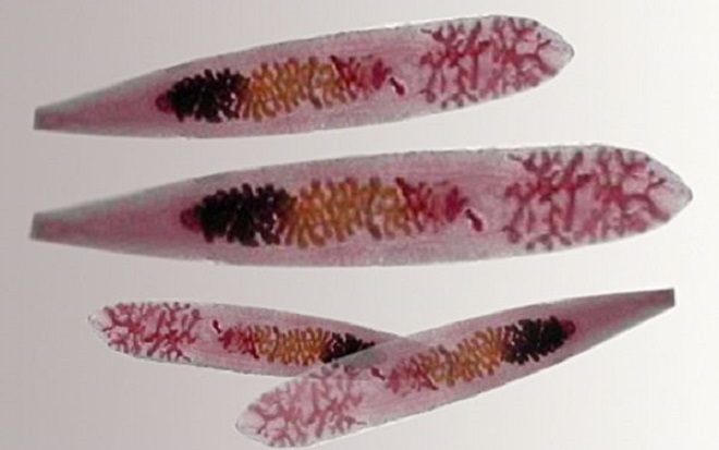 Описторхоз