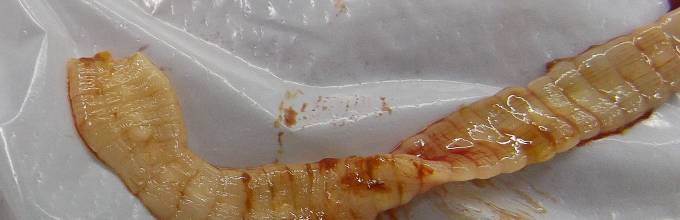 причина нейроцистицеркоза