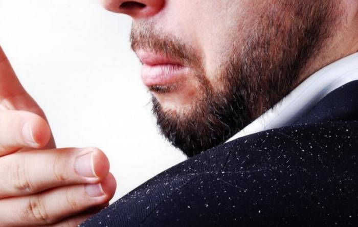 перхоть на одежде