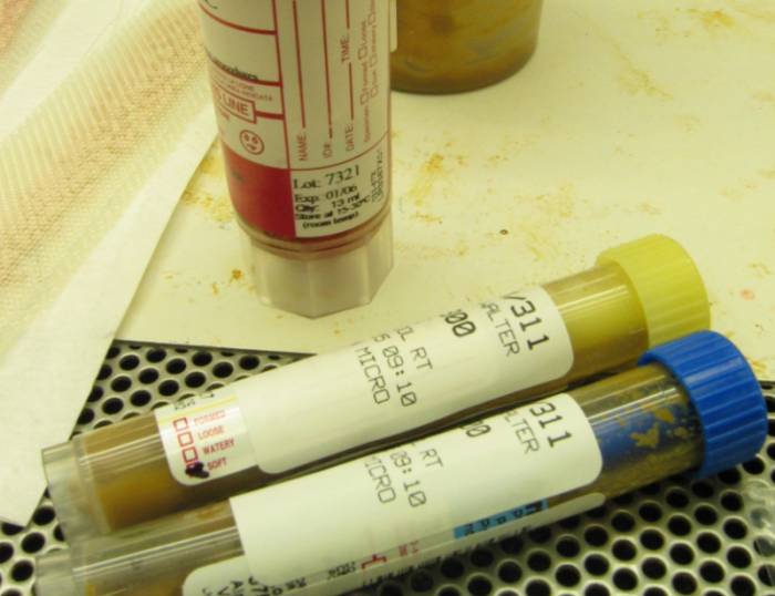 анализ на кал