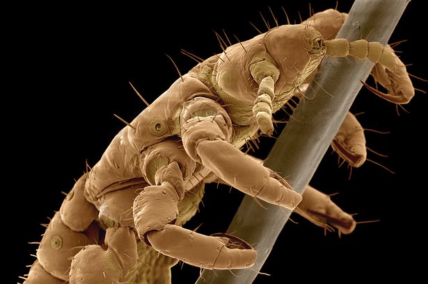 как выглядят вши