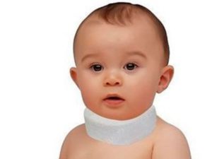 Вывих шейного позвонка у ребенка Воротник Шанца