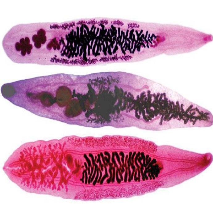 Описторхоз