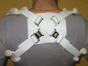 кольца Дельбе Иммобилизация ключицы с применением колец Дельбе