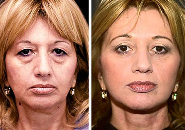 Хорошие крема для лица после 40