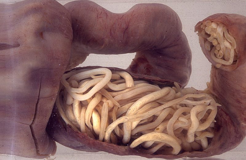 гельминтоз