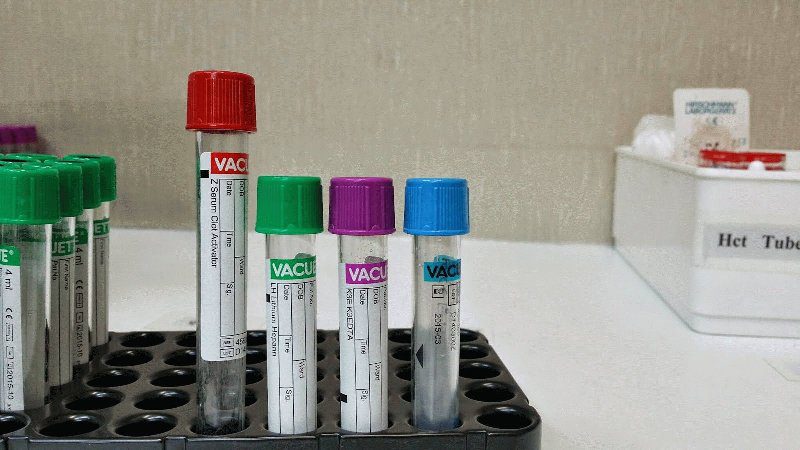 Диагностика энтеробиоза